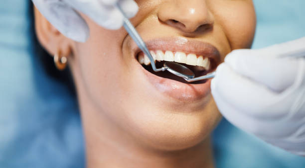 Best Same-Day Emergency Dentist in Comer, GA